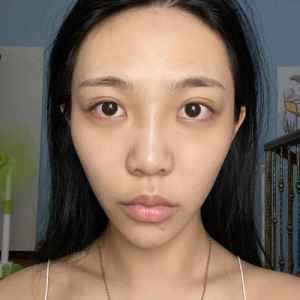 整形前后对比图片