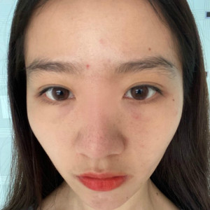 整形前后对比图片