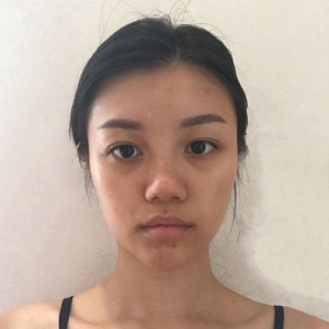 整形前后对比图片