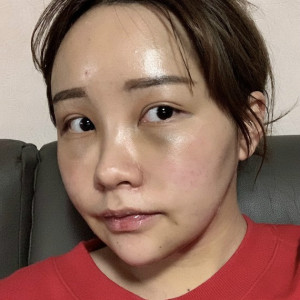 地球是圆的的整形术后图片