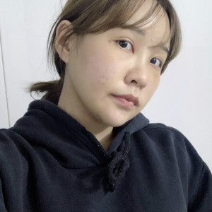 地球是圆的的整形术后图片