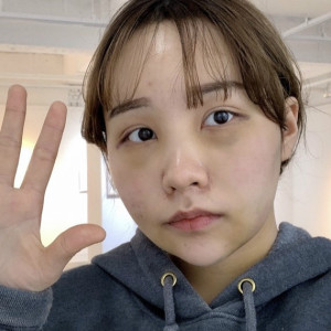 地球是圆的的整形术后图片