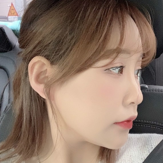 地球是圆的的整形术后图片