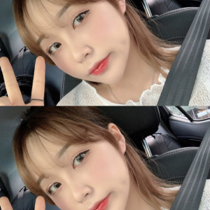 整形前后对比图片