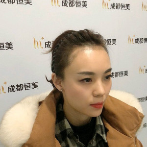 整形前后对比图片