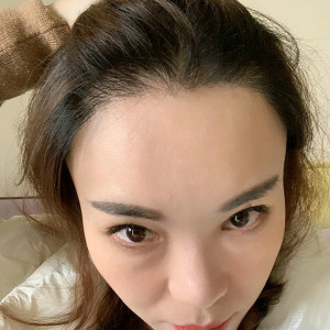 整形前后对比图片