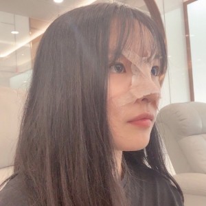 整形前后对比图片