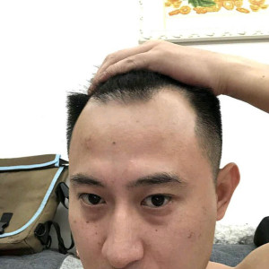 整形前后对比图片