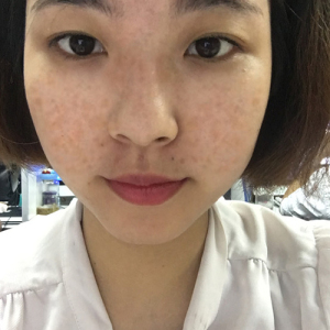 整形前后对比图片