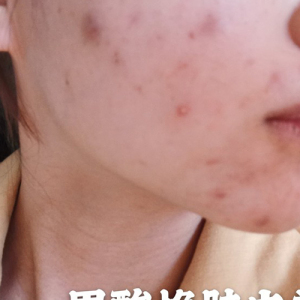 整形前后对比图片