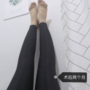 整形前后对比图片