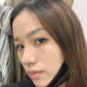 整形前后对比图片