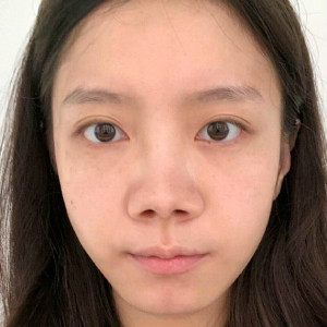 整形前后对比图片