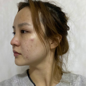 整形前后对比图片