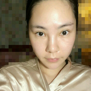 整形前后对比图片