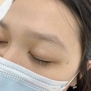 整形前后对比图片