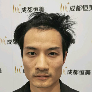 整形前后对比图片