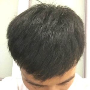 整形前后对比图片