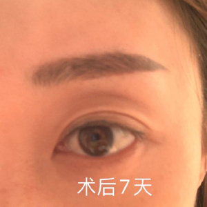 整形前后对比图片