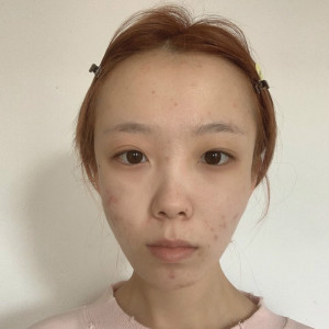 整形前后对比图片