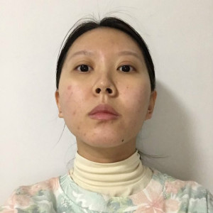 整形前后对比图片