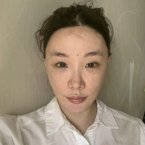 整形前后对比图片