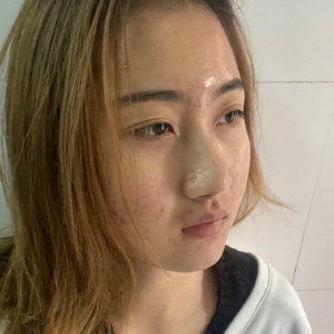 整形前后对比图片