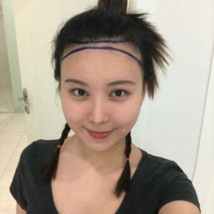 整形前后对比图片