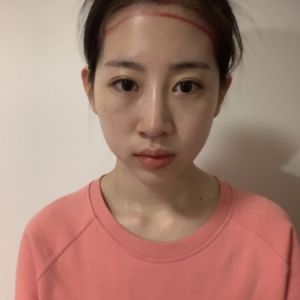 整形前后对比图片