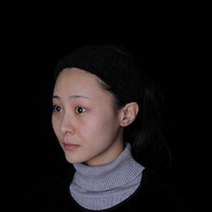 整形前后对比图片