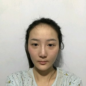 整形前后对比图片