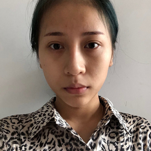 整形前后对比图片