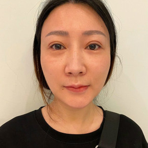 整形前后对比图片