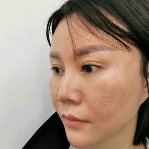 整形前后对比图片