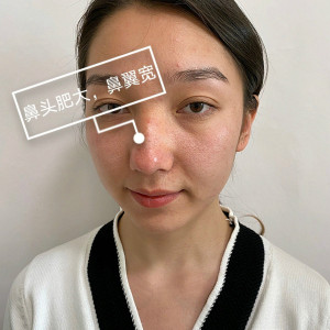 整形前后对比图片