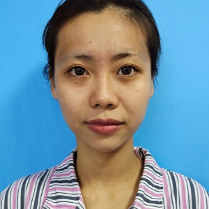 整形前后对比图片