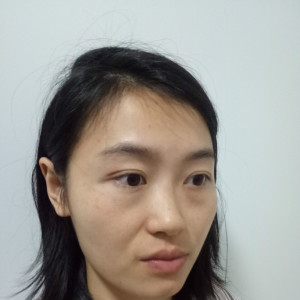 整形前后对比图片