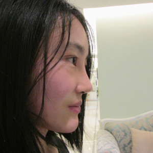 低调的、凤凰的整形术后图片