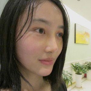 低调的、凤凰的整形术后图片