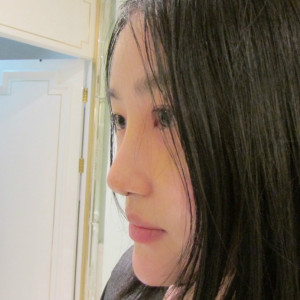 低调的、凤凰的整形术后图片