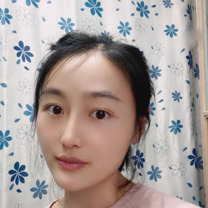 低调的、凤凰的整形术后图片