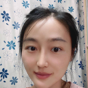 低调的、凤凰的整形术后图片