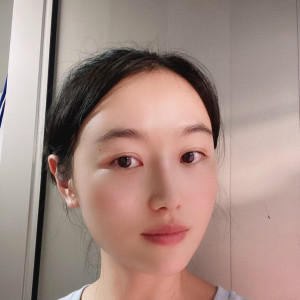 低调的、凤凰的整形术后图片