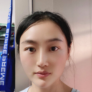 低调的、凤凰的整形术后图片