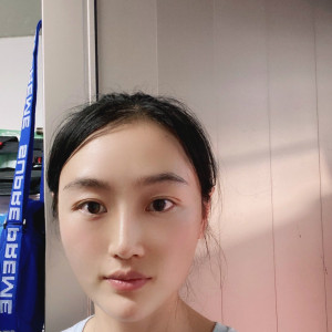 低调的、凤凰的整形术后图片