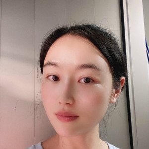 低调的、凤凰的整形术后图片