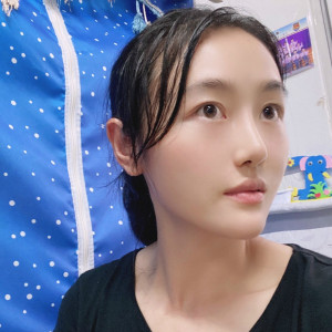 低调的、凤凰的整形术后图片