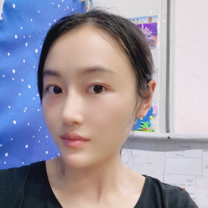 低调的、凤凰的整形术后图片