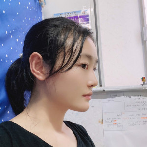 低调的、凤凰的整形术后图片