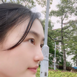 低调的、凤凰的整形术后图片